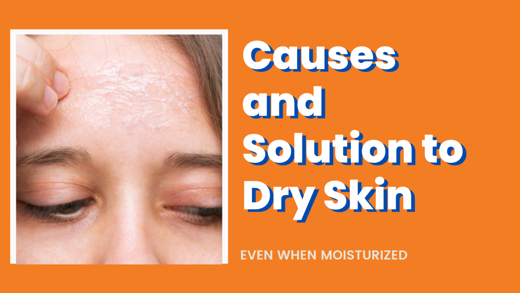 Causes and Solution to Dry Skin